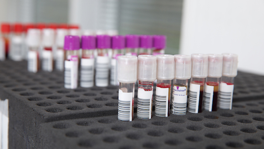 IBTS pilot blood tubes 2022